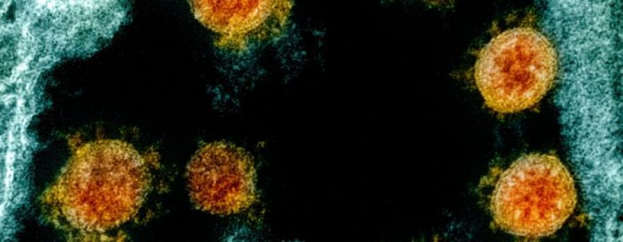 Antitijelo koje bi moglo da neutrališe koronavirus pronađeno na Univerzitetu u Pitsburgu