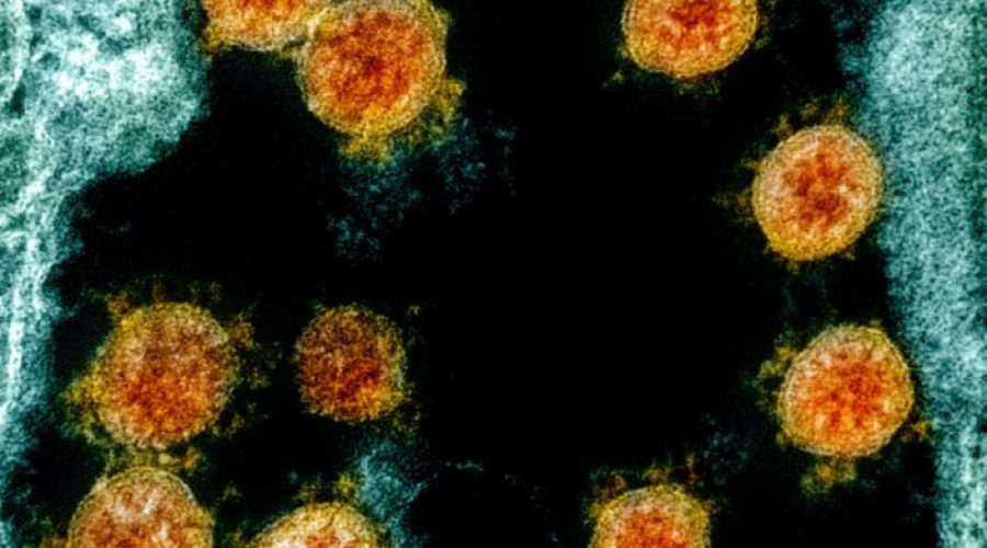 Antitijelo koje bi moglo da neutrališe koronavirus pronađeno na Univerzitetu u Pitsburgu