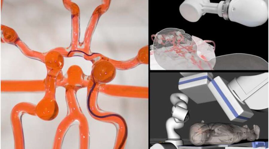 Robot sa džojstikom bi mogao pomoći hirurzima u liječenju moždanog udara na daljinu